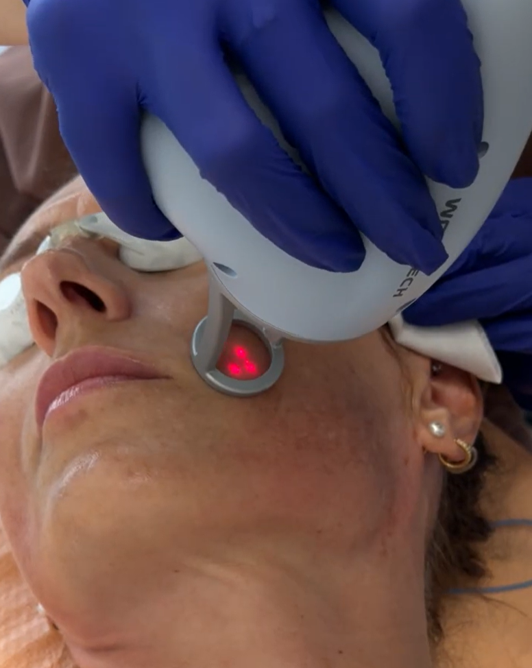 oryginalny laser tulowy w Gdańsku w Holiskin